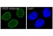 Immunofluorescent staining of FFPE human HeLa cells (green) and DAPI nuclear stain (blue). HIER: boil tissue sections in pH6, 10mM citrate buffer, for 10-20 min and allow to cool before testing.