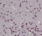 IHC staining of FFPE mouse brain with CREB1 antibody. HIER: boil tissue sections in pH6, 10mM citrate buffer, for 10-20 min and allow to cool before testing.