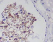 IHC staining of FFPE human kidney tissue with PECAM1 antibody. HIER: boil tissue sections in pH6, 10mM citrate buffer, for 10-20 min and allow to cool before testing.