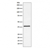 Western blot testing of mouse NIH3T3 cell lysate with CD152 antibody. Expected molecular weight: 30-43 kDa depending on level of glycosylation.