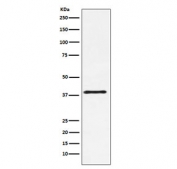 Western blot testing of mouse NIH3T3 cell lysate with CD152 antibody. Predicted molecular weight ~25 kDa but may be observed at higher molecular weights due to glycosylation.