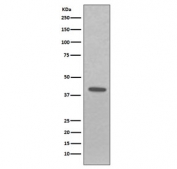 Western blot testing of human A431 cell lysate with EpCAM antibody. Expected molecular weight: ~35 kDa (unmodified), 40-43 kDa (glycosylated).