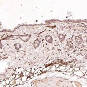 IHC staining of FFPE mouse skin tissue with CD19 antibody. HIER: boil tissue sections in pH6 citrate buffer for 20 min and allow to cool before testing.