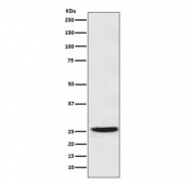 Western blot testing of human SW480 cell lysate with 15-PGDH antibody. Predicted molecular weight: ~29 kDa.