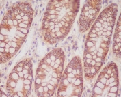 IHC staining of FFPE human colon tissue with CD46 antibody. HIER: boil tissue sections in pH6, 10mM citrate buffer, for 10-20 min and allow to cool before testing.
