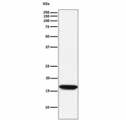 Western blot testing of human Jurkat cell lysate with NME1 antibody. Predicted molecular weight ~17 kDa.