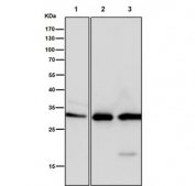 Western blot testing of human 1) HeLa, 2) HepG2 and 3) MCF7 cell lysate with NQO1 antibody. Predicted molecular weight ~30 kDa.