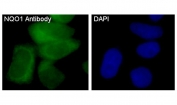 Immunofluorescent staining of FFPE human MCF7 cells with NQO1 antibody (green) and DAPI nuclear stain (blue).