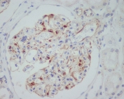 IHC staining of FFPE human kidney tissue with VEGFA antibody. HIER: boil tissue sections in pH6, 10mM citrate buffer, for 10-20 min and allow to cool before testing.