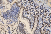 IHC staining of FFPE rat intestine with BRG1 antibody. HIER: boil tissue sections in pH6, 10mM citrate buffer, for 20 min and allow to cool before testing.
