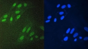 Immunofluorescent staining of FFPE human U-2 OS cells with ZEB1 antibody (green) and DAPI (blue). HIER: boil tissue sections in pH6, 10mM citrate buffer, for 20 min and allow to cool before testing.