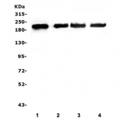Western blot testing of human 1) SGC-7901, 2) U-87 MG, 3) HEK293 and 4) PC-3 cell lysate with ZEB1 antibody. Predicted molecular weight ~124 kDa but observed at up to ~200 kDa.