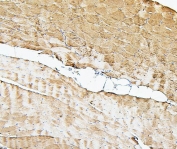 IHC staining of FFPE human skeletal muscle with Cofilin 2 antibody. HIER: boil tissue sections in pH6, 10mM citrate buffer, for 20 min and allow to cool before testing.