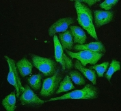 Immunofluorescent staining of FFPE human U-2 OS cells with Cofilin 2 antibody (green) and DAPI (blue). HIER: boil tissue sections in pH6, 10mM citrate buffer, for 20 min and allow to cool before testing.