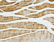 IHC staining of FFPE rat skeletal muscle with Cofilin 2 antibody. HIER: boil tissue sections in pH6, 10mM citrate buffer, for 20 min and allow to cool before testing.