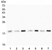 Western blot testing of human 1) HeLa, 2) U-2 OS, 3) HepG2, 4) T-47D, 5) Raji, 6) placenta and 7) A549 lysate with Cofilin 2 antibody. Predicted molecular weight ~19 kDa.