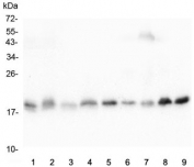 Western blot testing of 1) rat heart, 2) rat liver, 3) rat kidney, 4) rat brain, 5) mouse heart, 6) mouse liver, 7) mouse kidney, 8) mouse brain and 9) mouse NIH3T3 lysate with Cofilin 2 antibody. Predicted molecular weight ~19 kDa.