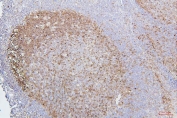 IHC staining of FFPE human tonsil with CDK1 antibody. HIER: boil tissue sections in pH6, 10mM citrate buffer, for 20 min and allow to cool before testing.