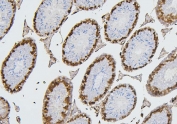 IHC staining of FFPE mouse testis with CDK1 antibody. HIER: boil tissue sections in pH6, 10mM citrate buffer, for 20 min and allow to cool before testing.