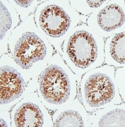 IHC staining of FFPE rat testis with CDK1 antibody. HIER: boil tissue sections in pH6, 10mM citrate buffer, for 20 min and allow to cool before testing.