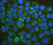 Immunofluorescent staining of FFPE human A431 cells with BAK1 antibody (green) and DAPI (blue). HIER: boil tissue sections in pH6, 10mM citrate buffer, for 20 min and allow to cool before testing.