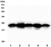 Western blot testing of human 1) HEK293, 2) A431, 3) SW620, 4) T-47D and 5) HepG2 cell lysate with BAK1 antibody. Expected molecular weight ~23 kDa.