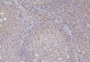 IHC staining of FFPE human tonsil with BAK1 antibody. HIER: boil tissue sections in pH6, 10mM citrate buffer, for 20 min and allow to cool before testing.