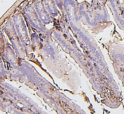 IHC staining of FFPE mouse intestine with BAK1 antibody. HIER: boil tissue sections in pH6, 10mM citrate buffer, for 20 min and allow to cool before testing.