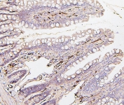 IHC staining of FFPE rat intestine with BAK1 antibody. HIER: boil tissue sections in pH6, 10mM citrate buffer, for 20 min and allow to cool before testing.