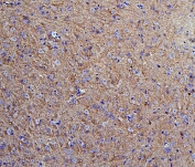 IHC staining of FFPE mouse brain with Hexokinase 1 antibody. HIER: boil tissue sections in pH8 EDTA for 20 min and allow to cool before testing.