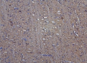 IHC staining of FFPE rat brain with Hexokinase 1 antibody. HIER: boil tissue sections in pH8 EDTA for 20 min and allow to cool before testing.