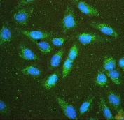 Immunofluorescent staining of FFPE human U-2 OS cells with Hexokinase 1 antibody (green) and DAPI nuclear stain (blue). HIER: steam section in pH6 citrate buffer for 20 min.