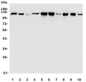 Western blot testing of human 1) placenta, 2) U-2 OS, 3) HEK293, 4) A549 and rat 5) brain, 6) heart, 7) lung and mouse 8) brain, 9) heart and 10) lung lysate with Hexokinase 1 antibody. Predicted molecular weight ~102 kDa.