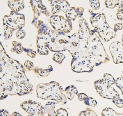 IHC staining of FFPE human placenta with IFNAR2 antibody. HIER: boil tissue sections in pH6, 10mM citrate buffer, for 20 min and allow to cool before testing.