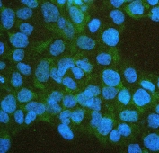 Immunofluorescent staining of FFPE human A431 with IFNAR2 antibody (green) and DAPI (blue). HIER: boil tissue sections in pH6, 10mM citrate buffer, for 20 min and allow to cool before testing.