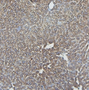IHC staining of FFPE mouse liver with IFNAR2 antibody. HIER: boil tissue sections in pH6, 10mM citrate buffer, for 20 min and allow to cool before testing.