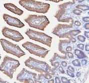 IHC staining of FFPE mouse intestine with IFNAR2 antibody. HIER: boil tissue sections in pH6, 10mM citrate buffer, for 20 min and allow to cool before testing.
