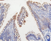 IHC staining of FFPE rat intestine with IFNAR2 antibody. HIER: boil tissue sections in pH6, 10mM citrate buffer, for 20 min and allow to cool before testing.