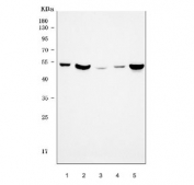 Western blot testing of human 1) placenta, 2) Caco-2, 3) K562, 4) U-2 OS and 5) MCF7 cell lysate with MMP1 antibody. Predicted molecular weight ~54 kDa (pro form).