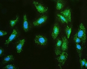 Immunofluorescent staining of FFPE human U-2 OS cells with MMP1 antibody (green) and DAPI (blue). HIER: boil tissue sections in pH6, 10mM citrate buffer, for 20 min and allow to cool before testing.