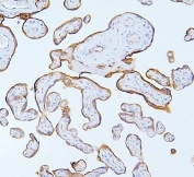 IHC staining of FFPE human placenta with MMP1 antibody. HIER: boil tissue sections in pH6, 10mM citrate buffer, for 20 min and allow to cool before testing.