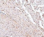 IHC staining of FFPE rat heart with PPCS antibody. HIER: boil tissue sections in pH6, 10mM citrate buffer, for 20 min and allow to cool before testing.