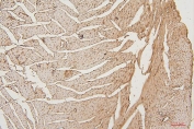 IHC staining of FFPE mouse heart with PPCS antibody. HIER: boil tissue sections in pH6, 10mM citrate buffer, for 20 min and allow to cool before testing.