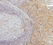 IHC staining of FFPE human tonsil with PPCS antibody. HIER: boil tissue sections in pH6, 10mM citrate buffer, for 20 min and allow to cool before testing.
