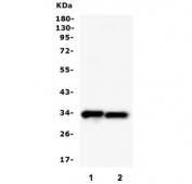 Western blot testing of human 1) A375 and 2) COLO-320 cell lysate with PPCS antibody. Predicted molecular weight ~34 kDa.