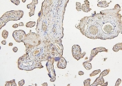 IHC staining of FFPE human placenta with IRS1 antibody. HIER: boil tissue sections in pH6, 10mM citrate buffer, for 20 min and allow to cool before testing.