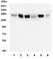 Western blot testing of human 1) A549, 2) T-47D, 3) Caco-2, 4) SW620, 5) HeLa and 6) Raji lysate with IRS1 antibody. Expected molecular weight: 132~185 kDa depending on phosphorylation level.