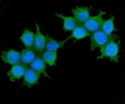 IF/ICC staining of FFPE human MCF7 cells with IRS1 antibody (green) at 2ug/ml and DAPI nuclear stain (blue). HIER: steam section in pH6 citrate buffer for 20 min.