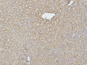 IHC staining of FFPE rat liver with Hsp60 antibody. HIER: boil tissue sections in pH6, 10mM citrate buffer, for 20 min and allow to cool before testing.