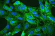 Immunofluorescent staining of FFPE human A549 with ALDH1A1 antibody (green) and DAPI (blue). HIER: boil tissue sections in pH6, 10mM citrate buffer, for 20 min and allow to cool before testing.